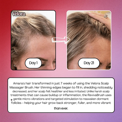Velora Red Light Scalp Brush – Soothe & Strengthen Hair